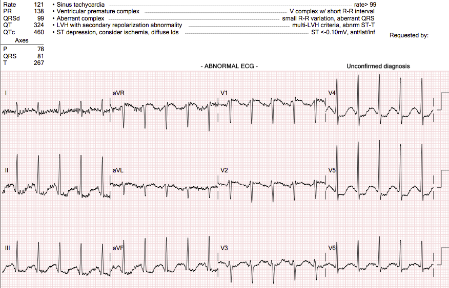 ekg4