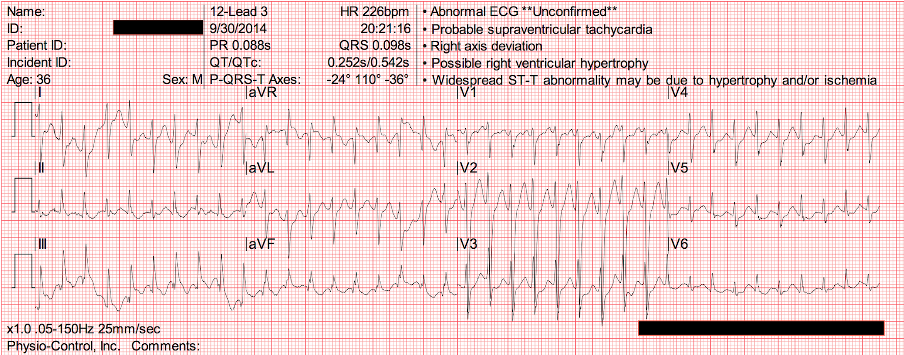 ekg2-3