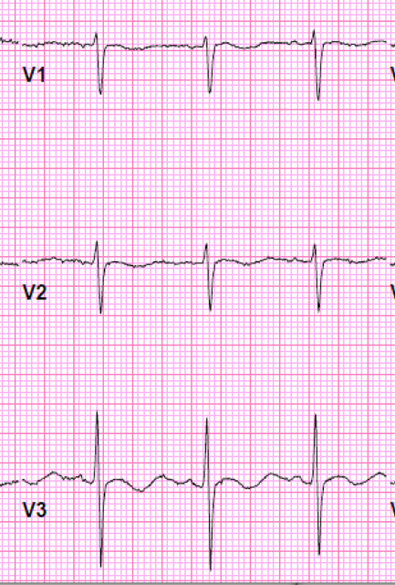 ekg2