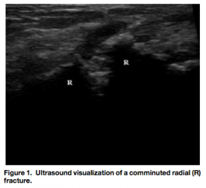 hematoma block 1