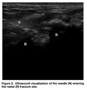 hematoma block 3
