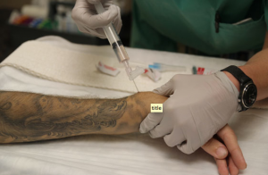 needle