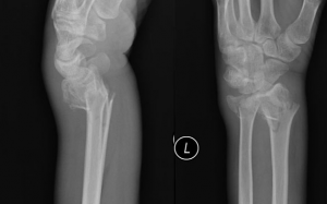 xrays