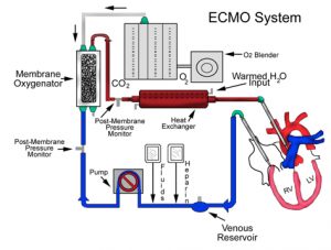 ECMO diagram
