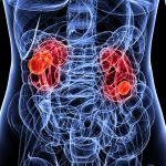 Kidney