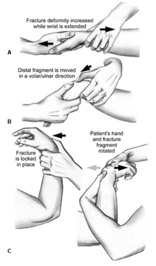EmDOCs Emergency Medicine EducationWrist And Distal Forearm EmDOCs Emergency Medicine EducationWrist And Distal Forearm