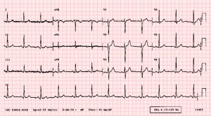 ecg1