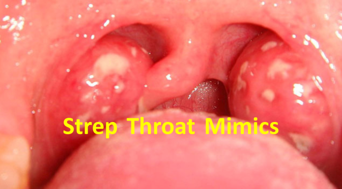 streptococcus throat