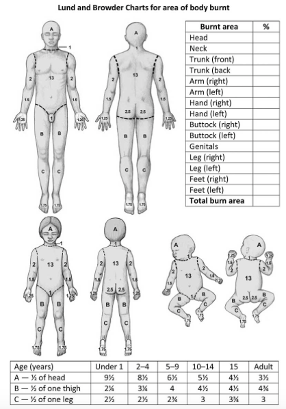 Paediatric Burns Chart