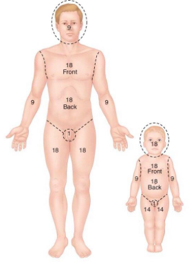 Ems Burn Chart