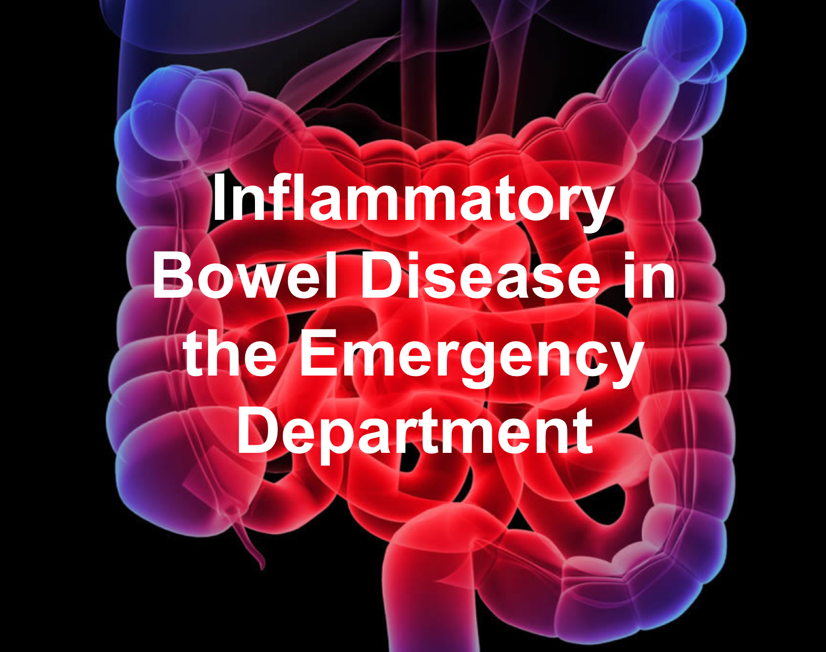 inflammatory bowel disease