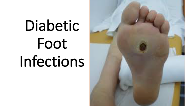 diabetic foot infection cukorbetegség oroklodes