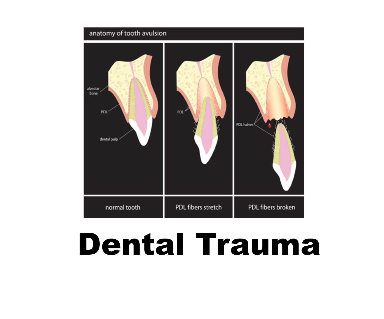 luxated teeth definition