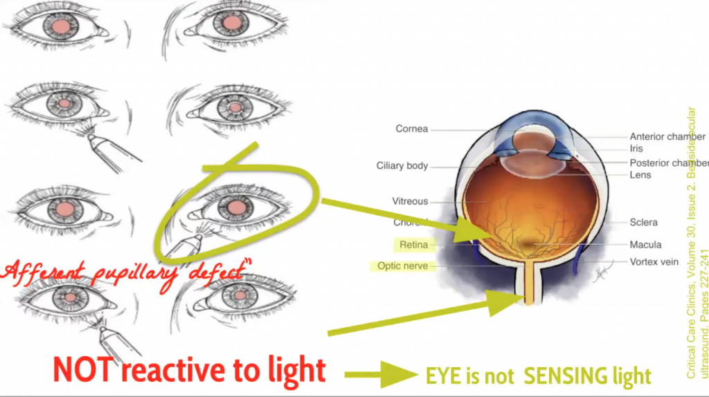 Emergency Medicine EducationEM in 5 Ocular Trauma
