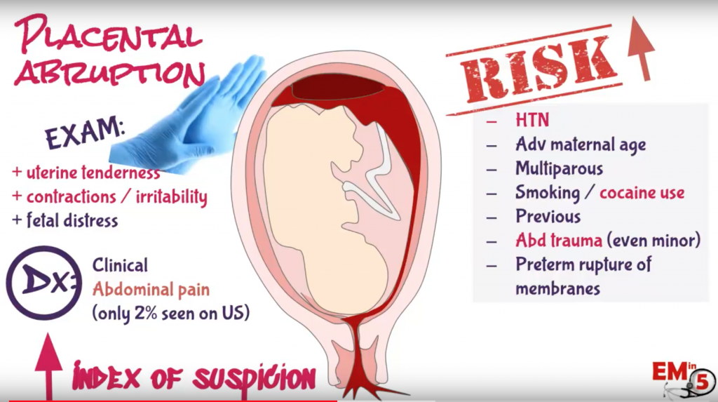 The Bleeding Placenta Effect On The Development Of Your Baby