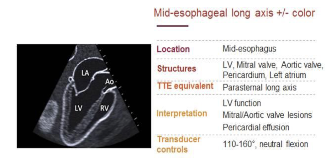 Basic Perioperative Transesophageal Echocardiography