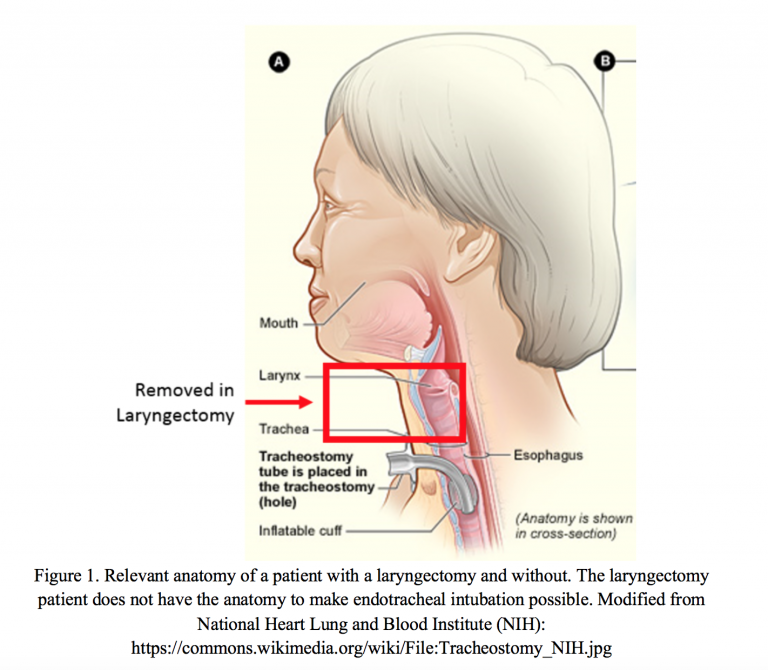 Emergency Medicine EducationTrach Travails NeedtoKnow