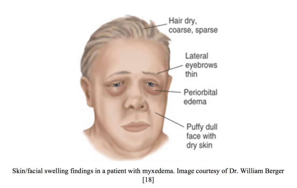 Causes Of Face Swelling At Cody Schlater Blog