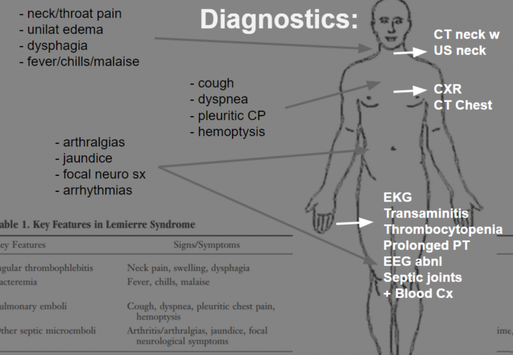 emDOCs.net – Emergency Medicine EducationEM in 5 Lemierre’s Syndrome