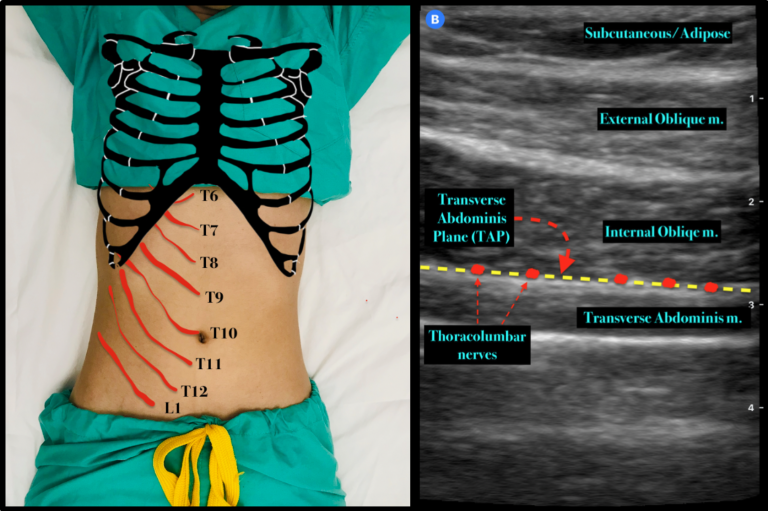 Emergency Medicine EducationPain Profiles ‘TAP IN