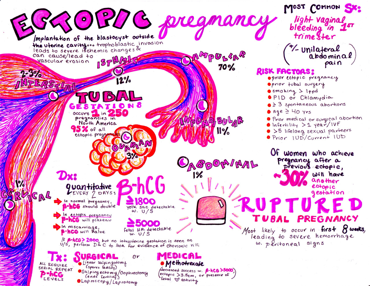 emdocs-emergency-medicine-educationobcast-ectopic-pregnancy