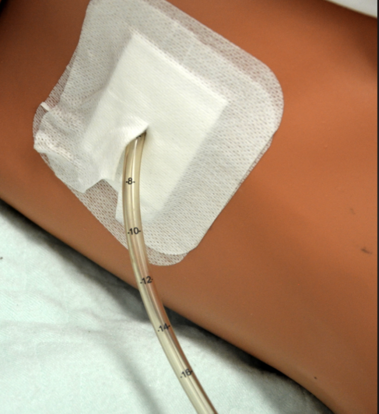 Unlocking Common ED Procedures Cutting Through the Triangle A Review