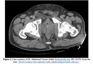 prostatitis diagnosis ct scan