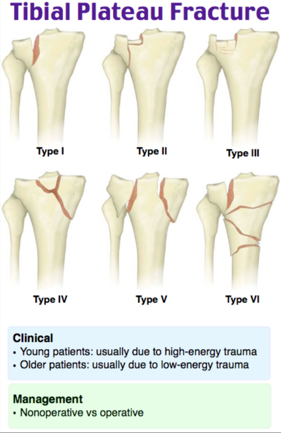 Emergency Medicine Educationem3am Tibial Plateau