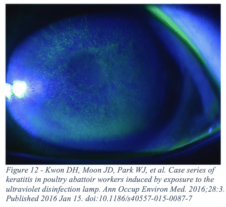 Emergency Medicine EducationApproach to the Red Eye