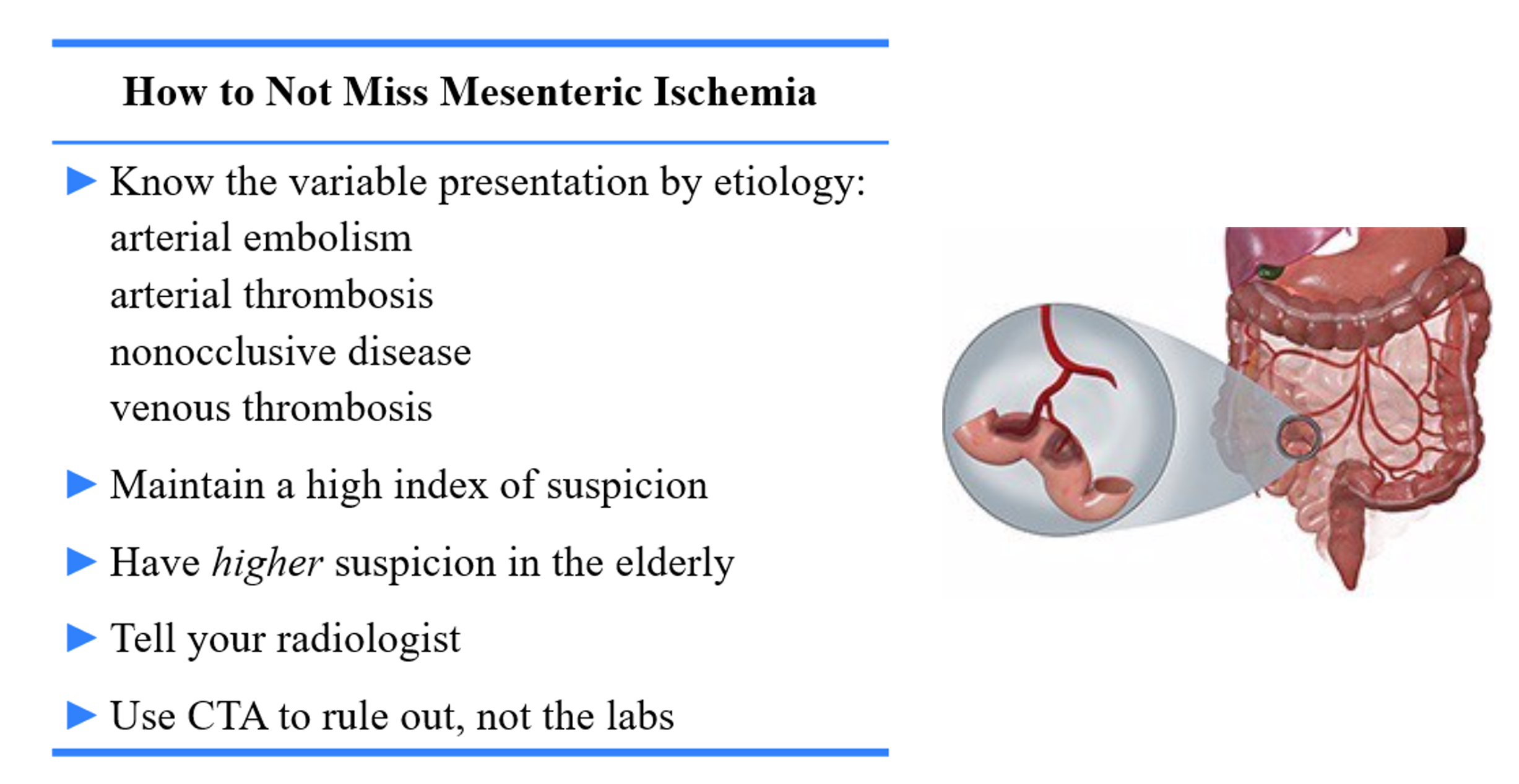 Ischemia ECG in