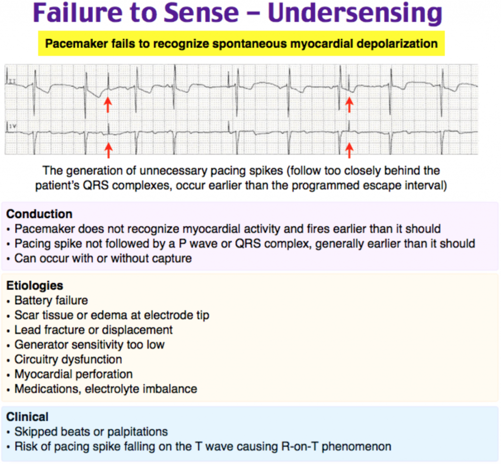 Emergency Medicine EducationEM3AM Pacemaker/AICD