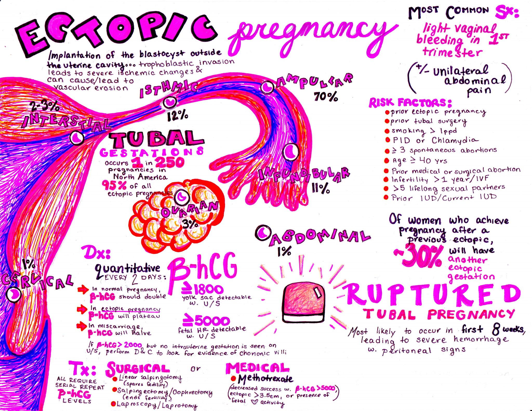 The EM Educator Series: Ectopic Pregnancy