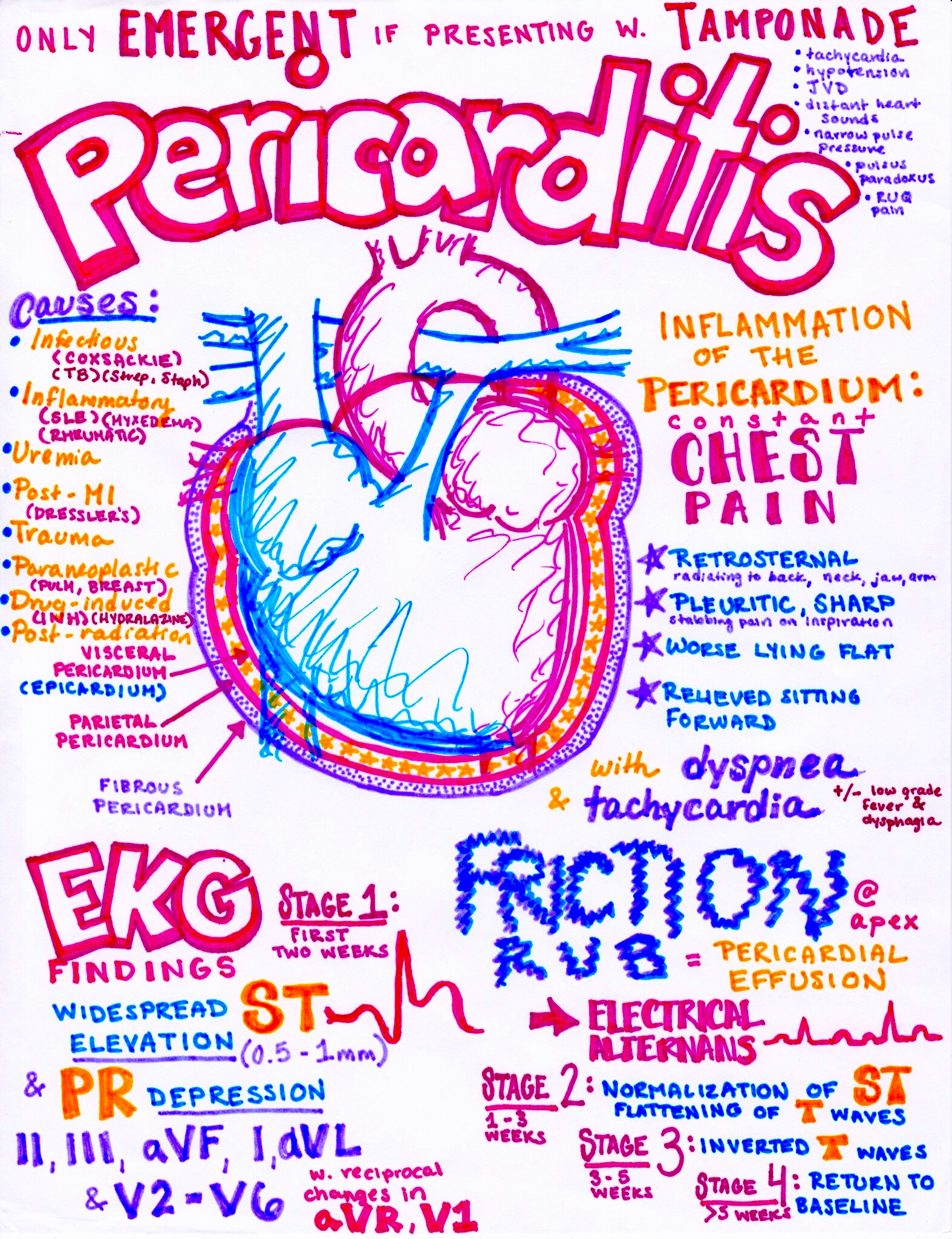 The EM Educator Series: Pericarditis