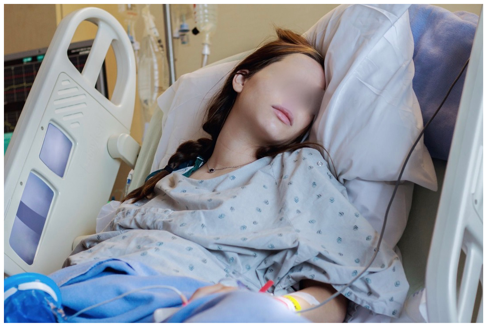 Medical Malpractice Insights: Teens can have strokes too.