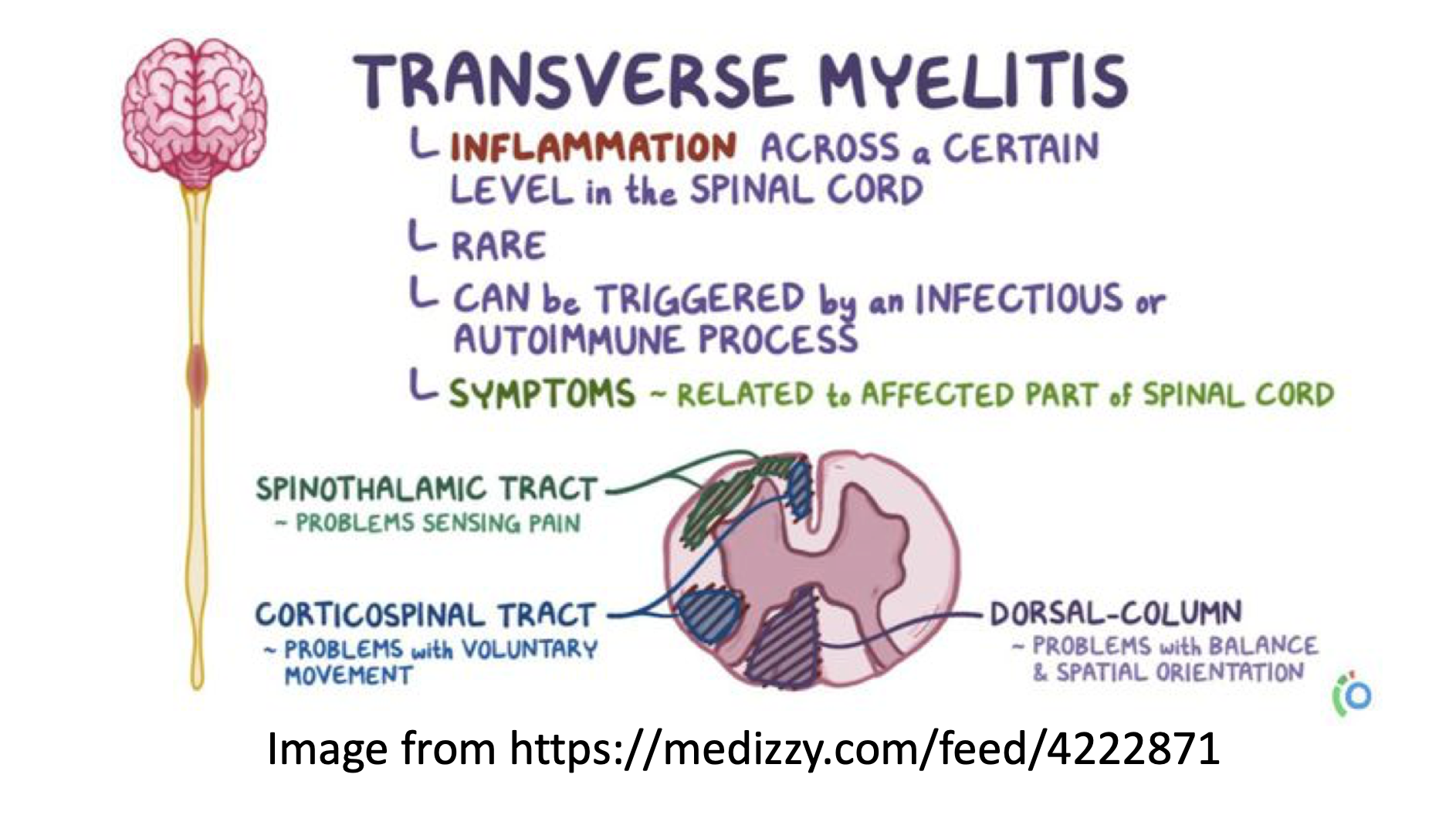 Medical Malpractice Insights: Transverse myelitis leaves patient quadriplegic