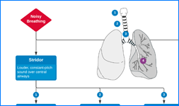 An Algorithm for the Diagnosis of Wheezing and Stridor