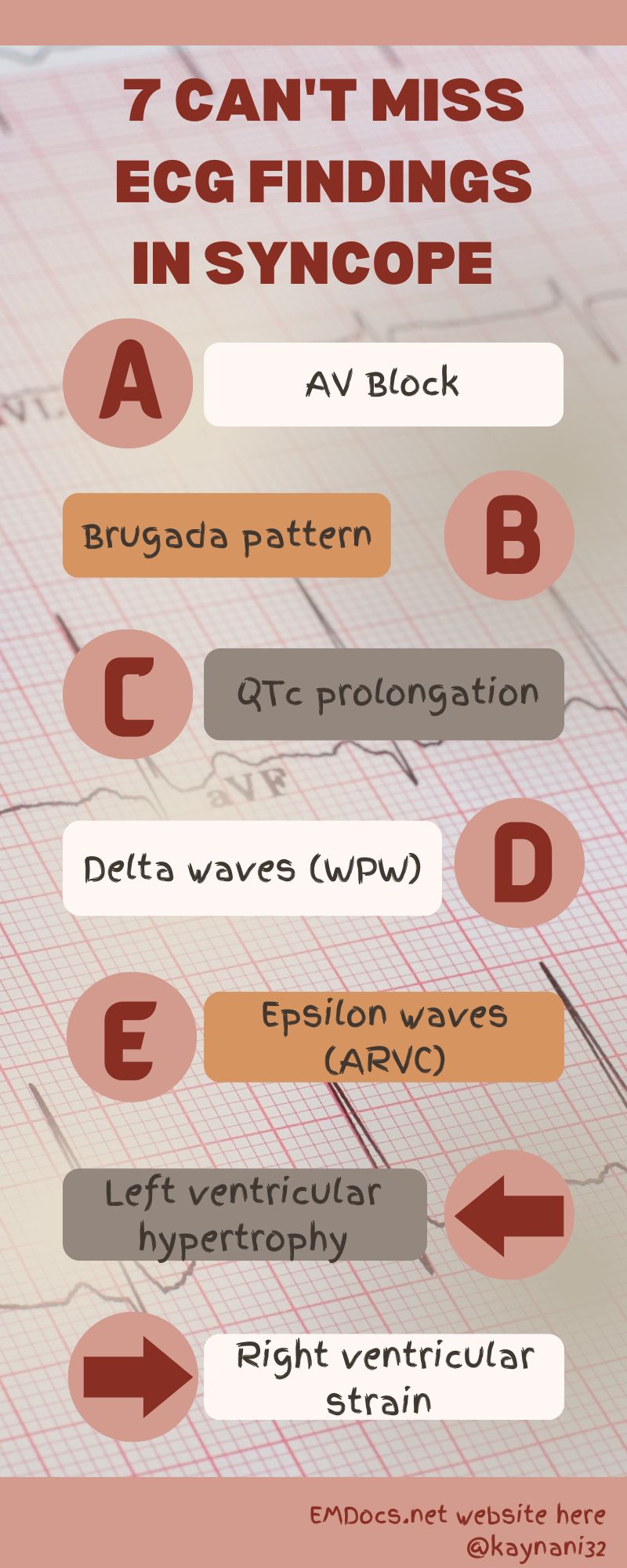 ECG Pointers: 7 Can’t-Miss ECG Patterns of High-Risk Syncope – the “ABCDE Left Right” Mnemonic