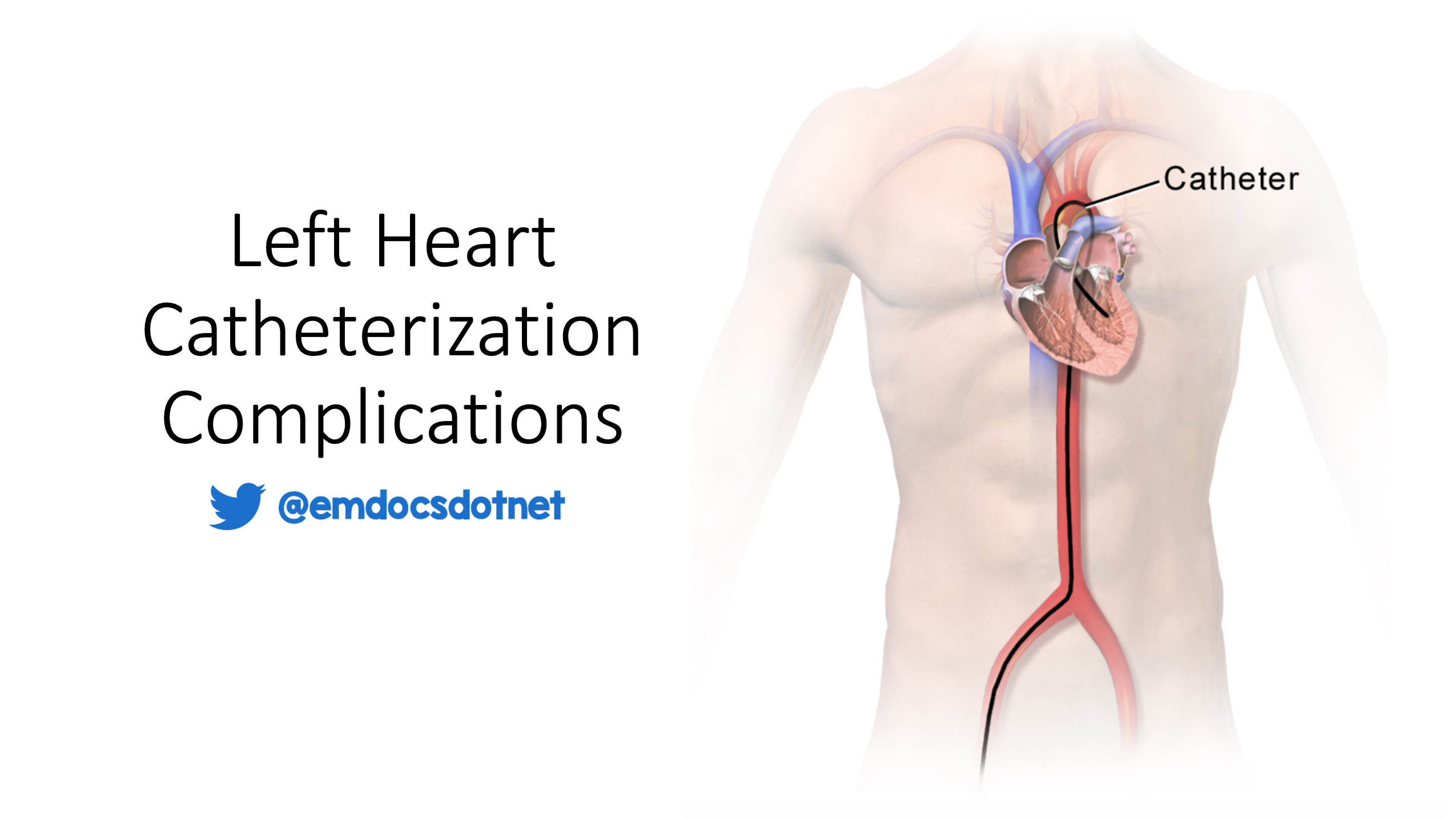 Emergency Medicine Educationleft Heart Catheterization