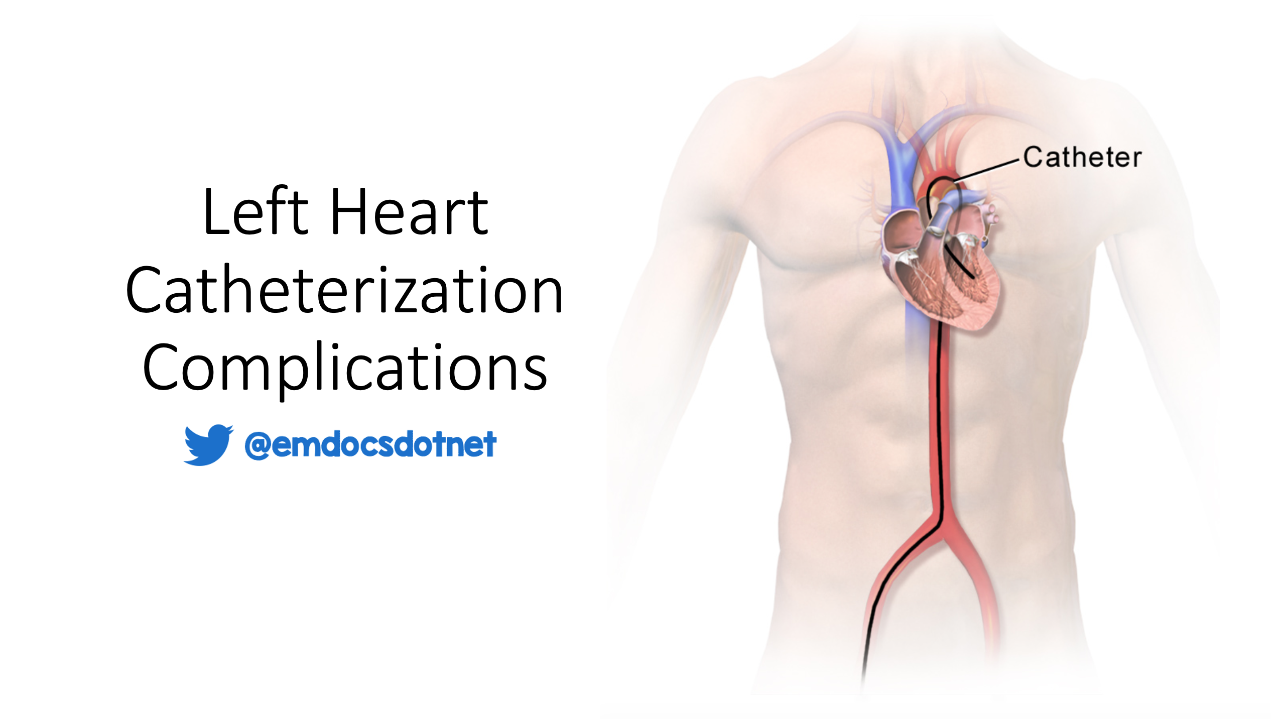 EmDOCs Emergency Medicine EducationLeft Heart Catheterization 