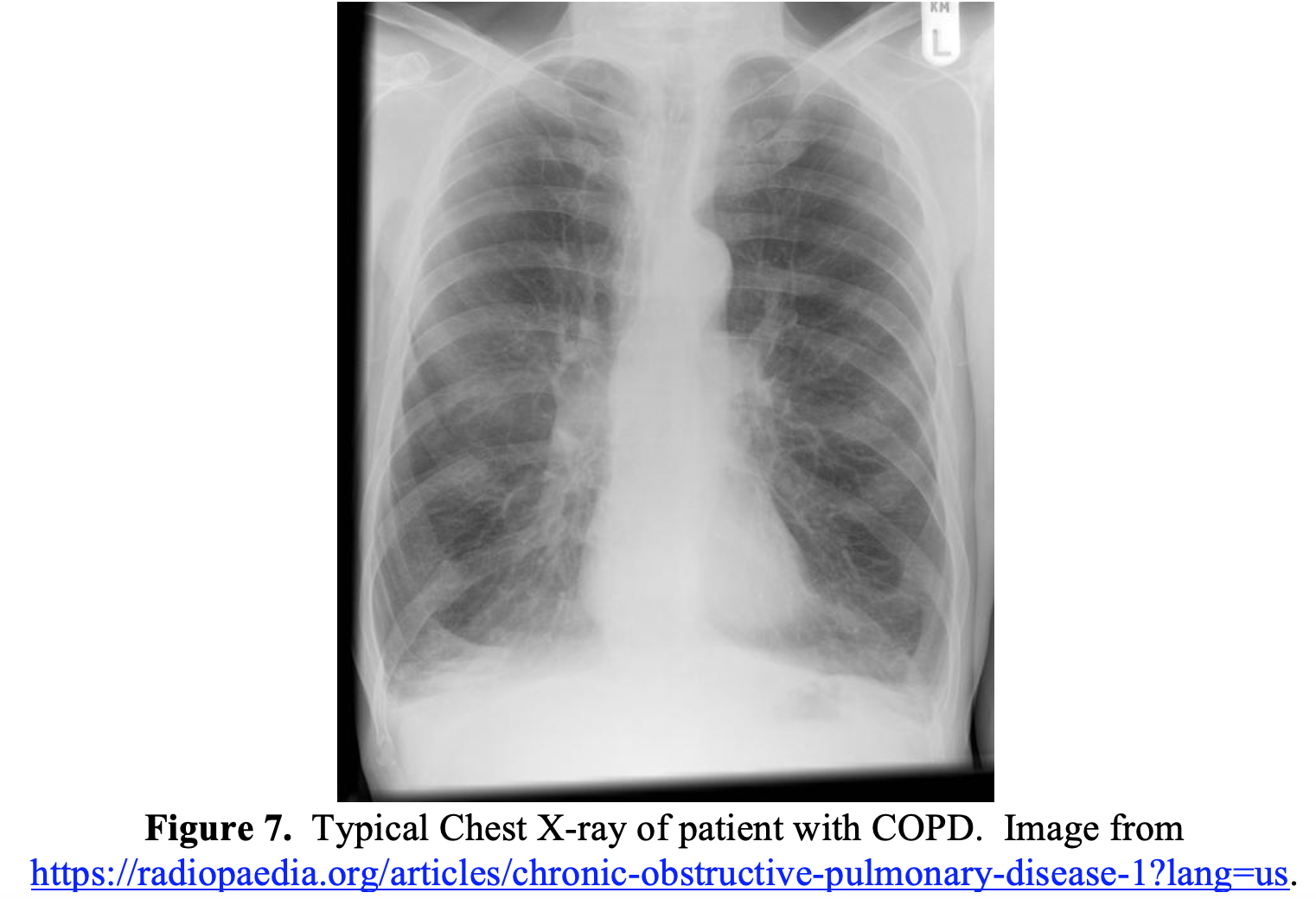 emDOCs.net – Emergency Medicine EducationScreen Shot 2020-07-04 at 6.16 ...