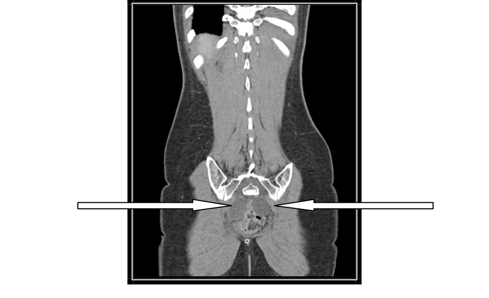 image1a