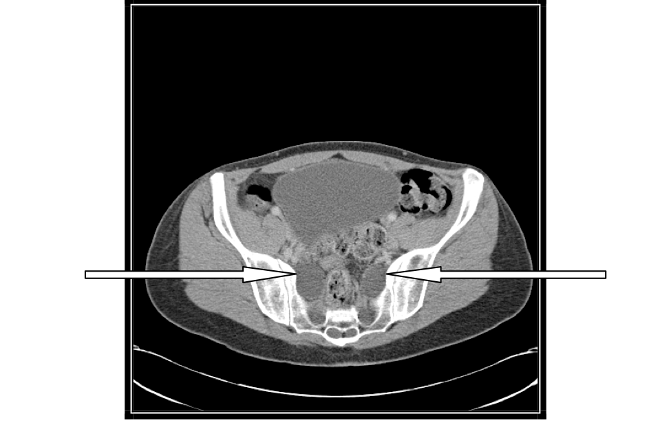 image2a
