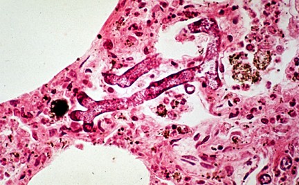 fungus