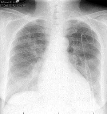 cxr