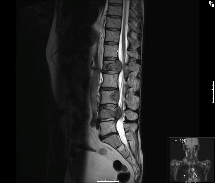 mri