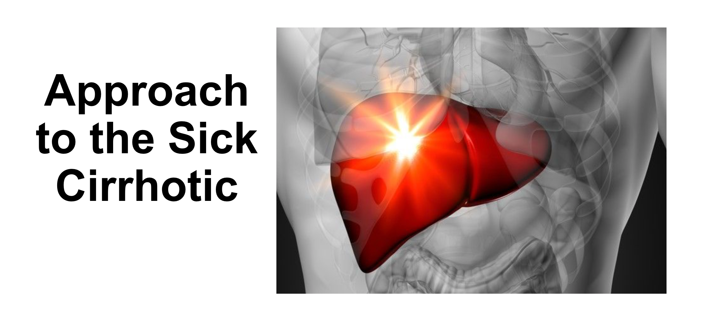 emDOCs.net – Emergency Medicine EducationApproach to the Sick Cirrhotic ...