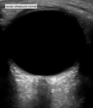 eye in screen
