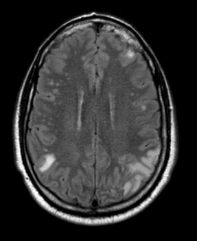 ct head