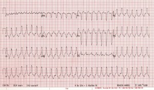 ekg2