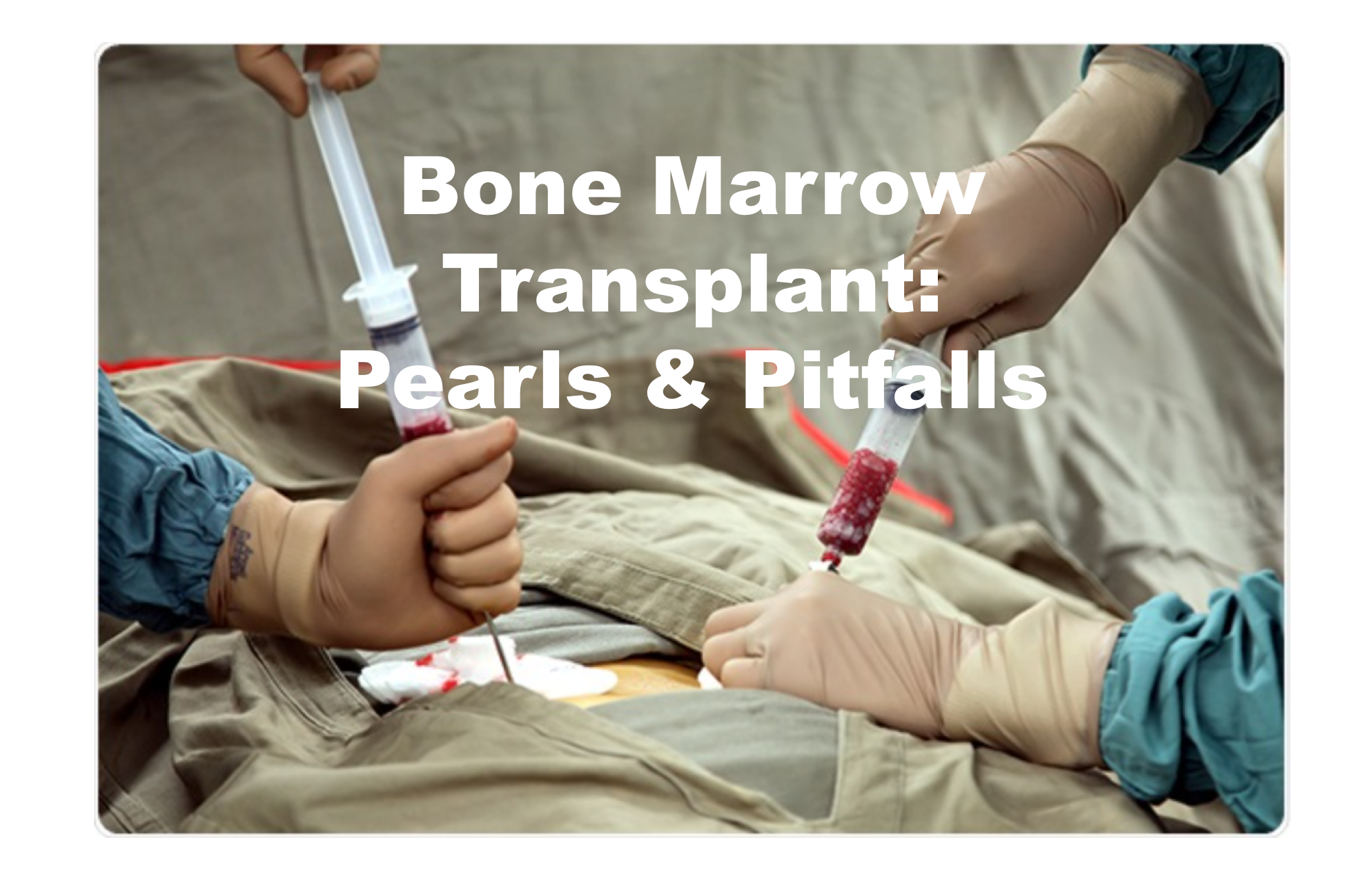 emDOCs net Emergency Medicine Educationbone marrow transplant emDOCs net Emergency Medicine Educationbone marrow transplant